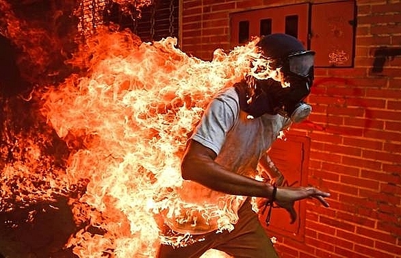 'Burning man' image wins top prize at World Press Photo awards