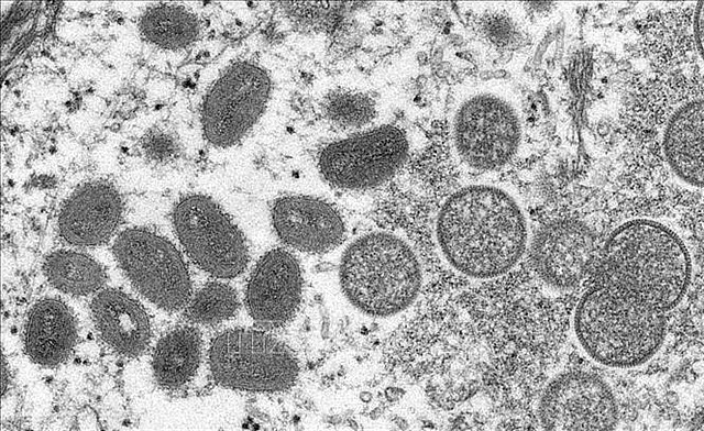 HCM City health authorities report Vietnam’s first case of monkeypox