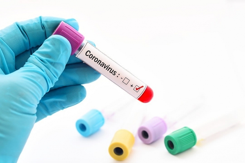 Possible coronavirus drug identified by Monash University scientists