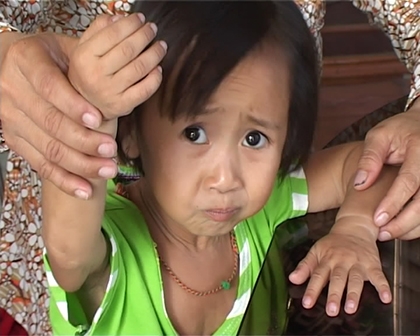 dhl provides pro bono service to help little ai tran in vietnam