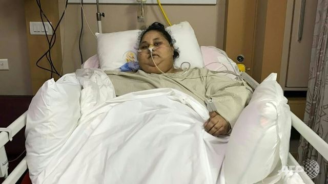 'World's heaviest woman' has surgery in India, loses 100kg