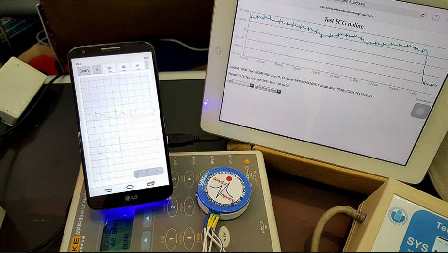 smartphone helps diagnose cardiovascular diseases via internet