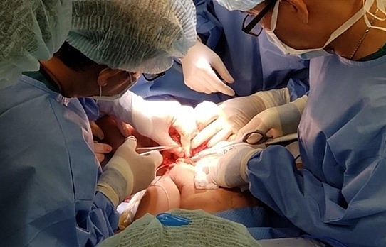 HCM City's doctors separate conjoined twins
