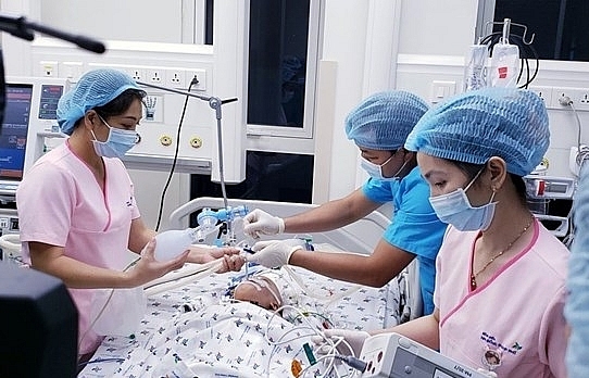 Conjoined twins in stable condition after separating operation