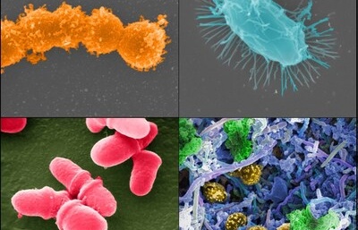 City microbes surviving on disinfectants, research reveals