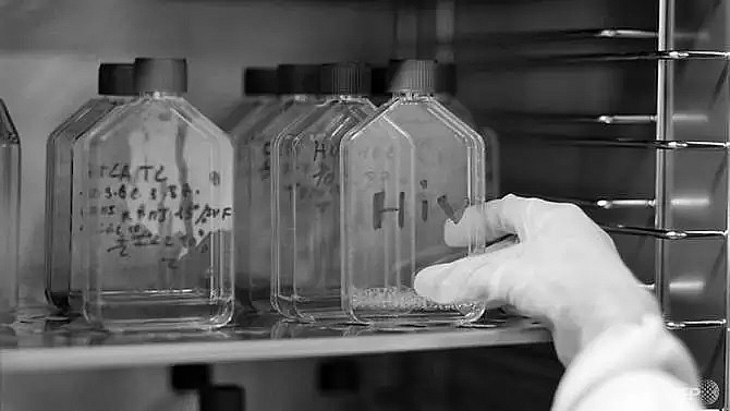 us laboratory identifies rare new hiv strain